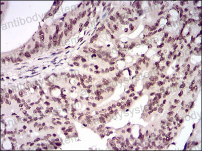 Валидация AntibodySystem RHF86206