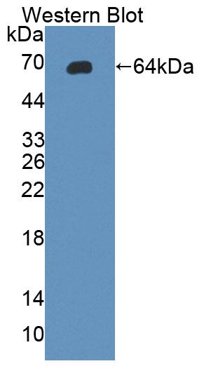 38700