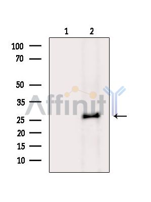 Валидация Affinity DF15858 - 12364