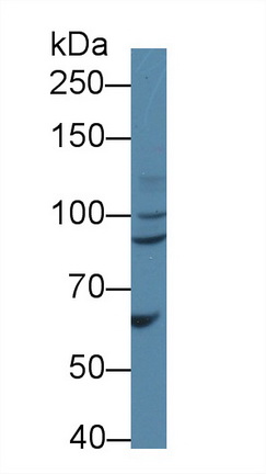 12625
