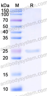 EHJ17401, SDS-PAGE