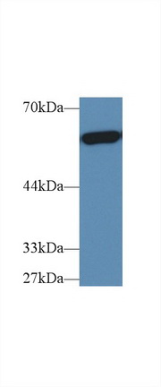 14554