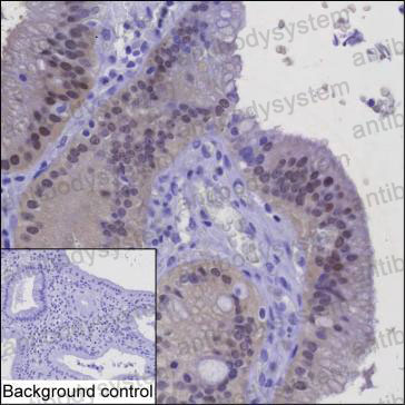 Валидация AntibodySystem RHC14701