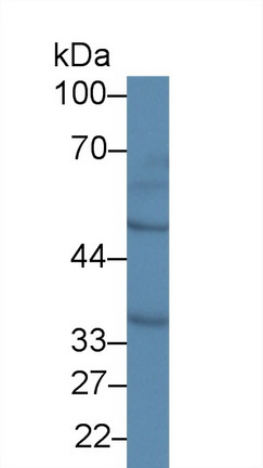 12701