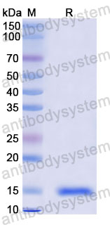 Валидация SDS-PAGE - AntibodySystem RXX10101
