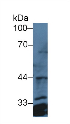 14207