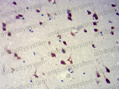 Валидация AntibodySystem RHA61301 (178)
