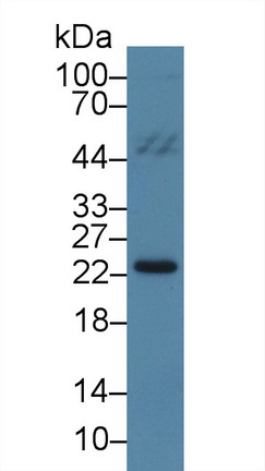 13977