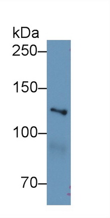 9362