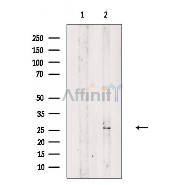Валидация Affinity DF8664 - 20632
