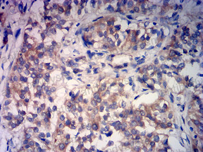 Валидация AntibodySystem RHN98402 (4032)