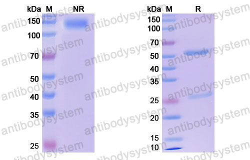 Валидация SDS-PAGE - AntibodySystem DHD46603