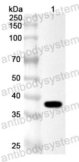 Валидация AntibodySystem PXX20701