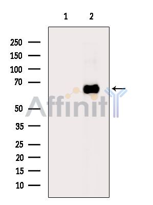 Валидация Affinity DF15511 - 11891