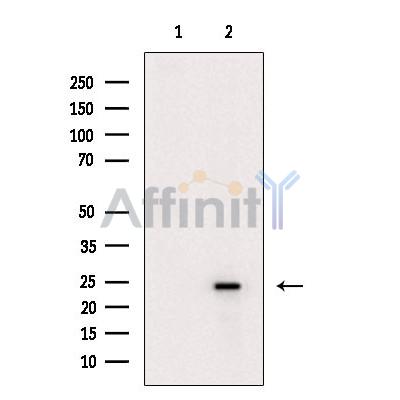 Валидация Affinity DF6252 - 17541