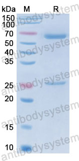 Валидация SDS-PAGE - AntibodySystem FMJ93230