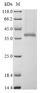 SDS-PAGE