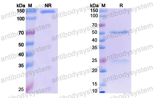 Валидация SDS-PAGE - AntibodySystem FHJ92840