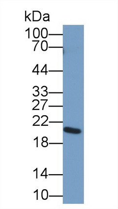 12351