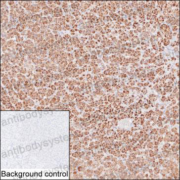 Валидация AntibodySystem RHE67803