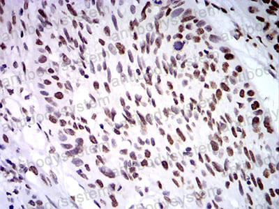Валидация AntibodySystem RHN95902