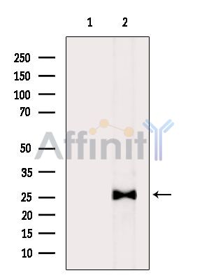 Валидация Affinity DF14937 - 11113