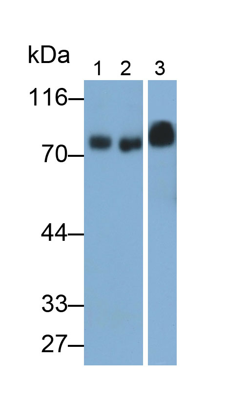 31818