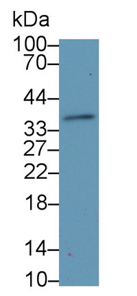 65278