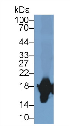 17625