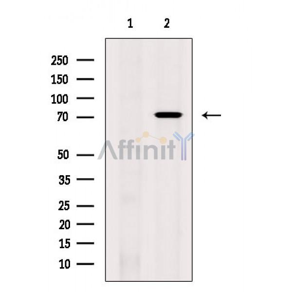 Валидация Affinity AF6345 - 3627