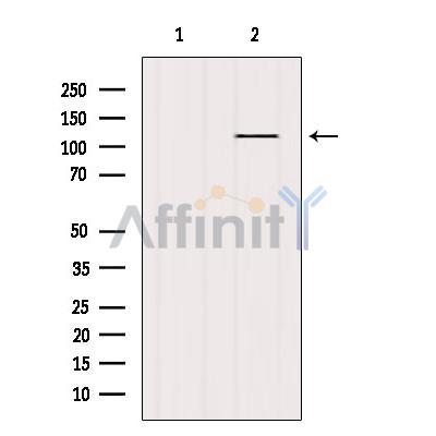 Валидация Affinity AF6137 - 3356