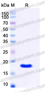 YHD67302, SDS-PAGE