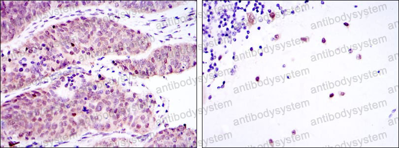 Валидация AntibodySystem RHK49602