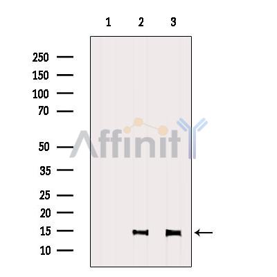 Валидация Affinity DF6277 - 17579