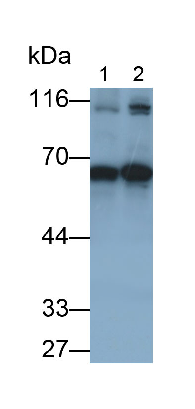 31398