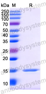 Валидация SDS-PAGE - AntibodySystem RVV09905