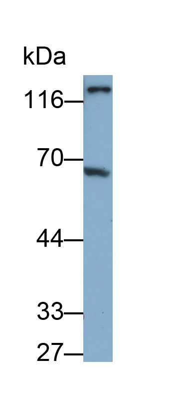 28418