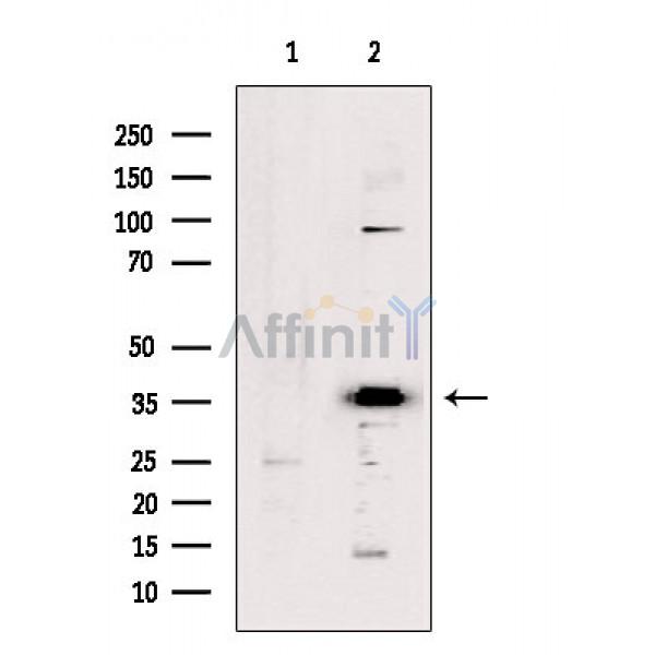 Валидация Affinity DF5104 - 17037