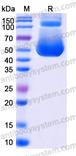 EHJ57503, SDS-PAGE
