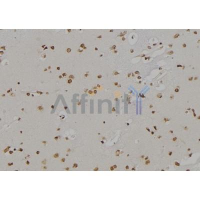 Валидация Affinity DF6881 - 18473