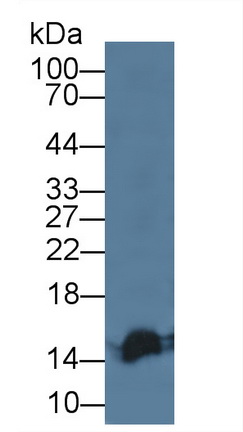 17665