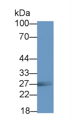 21817