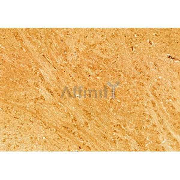 Валидация Affinity AF5185 - 2619