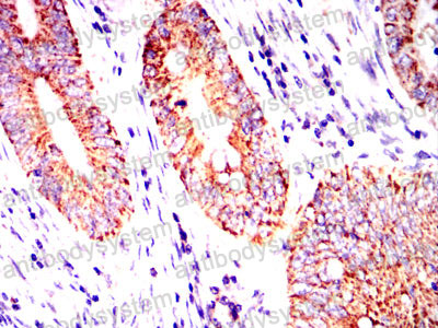 Валидация AntibodySystem RHN06803 (3795)
