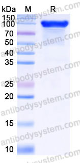 EHC14802, SDS-PAGE