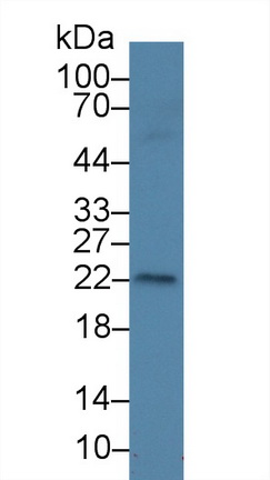 14260