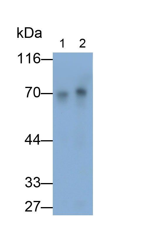 31690