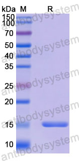 Валидация SDS-PAGE - AntibodySystem RHD47901
