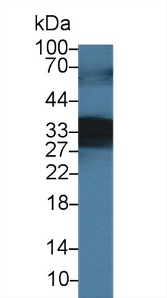 9531