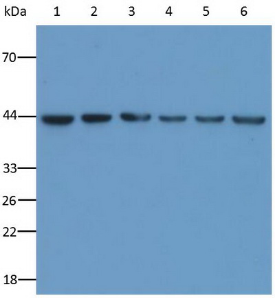 15114